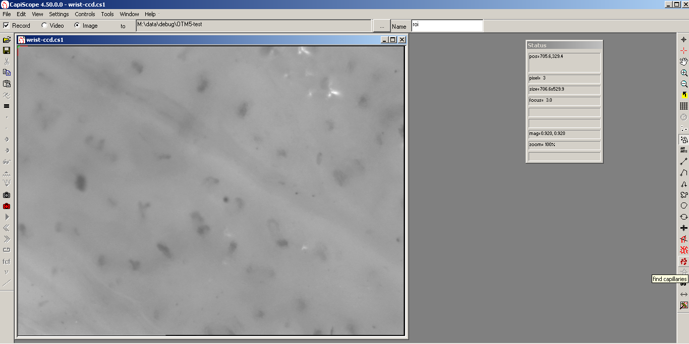 ../_images/findcaps450.png