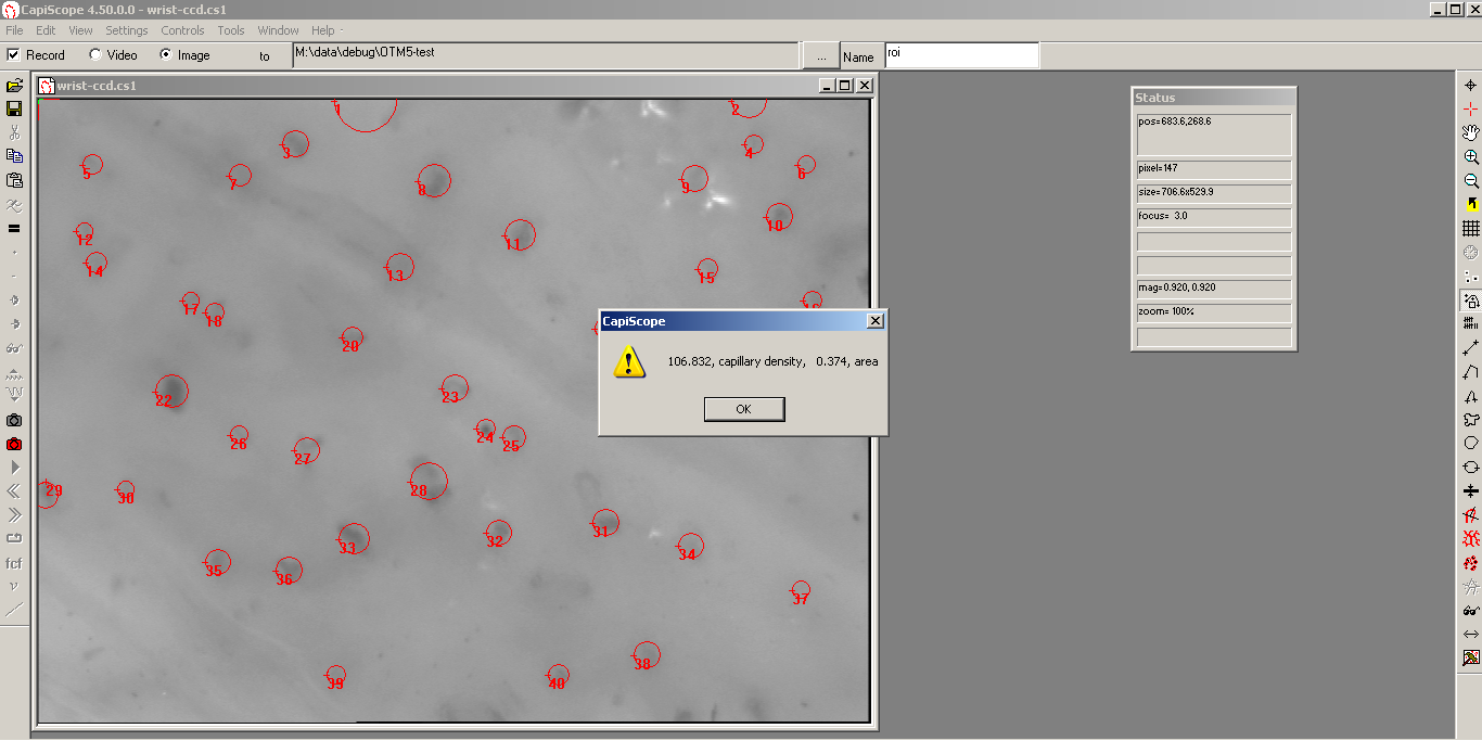 ../_images/foundcaps450.png